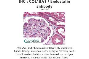 Image no. 1 for anti-Collagen, Type XVIII, alpha 1 (COL18A1) (full length) antibody (ABIN1724517) (COL18A1 anticorps  (full length))