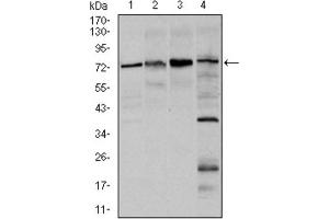 Western blot analysis using FOXO1 antibody against Hela (1), HEK293 (2), MCF-7 (3), and C6 (4) cell lysate. (FOXO1 anticorps)