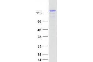 Validation with Western Blot