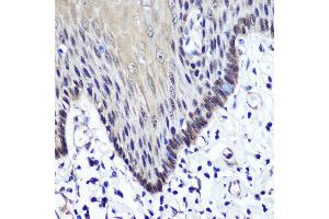 Immunohistochemistry of paraffin-embedded Human esophageal using TKT antibody (ABIN6128870, ABIN6149201, ABIN6149203 and ABIN6221921) at dilution of 1:100 (40x lens).