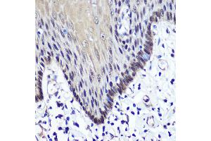Immunohistochemistry of paraffin-embedded Human esophageal using TKT antibody (ABIN6128870, ABIN6149201, ABIN6149203 and ABIN6221921) at dilution of 1:100 (40x lens). (TKT anticorps  (AA 1-280))