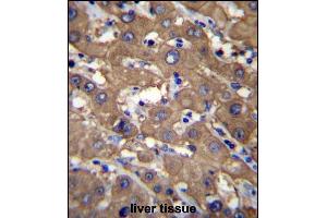 UGDH Antibody (C-term) (ABIN656544 and ABIN2845808) immunohistochemistry analysis in formalin fixed and paraffin embedded human liver tissue followed by peroxidase conjugation of the secondary antibody and DAB staining.