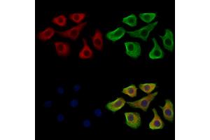ABIN7094714 and ABIN7098765 staining Hela cells by IF/ICC.