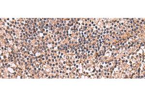 Immunohistochemistry of paraffin-embedded Human tonsil tissue using NOTCH4 Polyclonal Antibody at dilution of 1:30(x200)