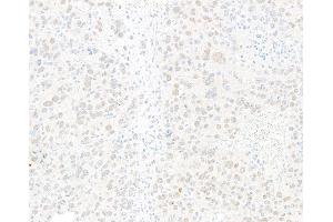 Immunohistochemistry (IHC) image for anti-Jun Dimerization Protein 2 (JDP2) (AA 50-100) antibody (ABIN7795636) (Recombinant JDP2 anticorps  (AA 50-100))
