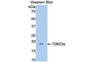 Western blot analysis of the recombinant protein. (IL-7 anticorps  (AA 26-154))
