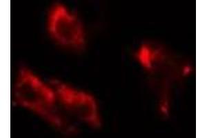 ABIN6275757 staining HuvEC cells by IF/ICC. (DGKB anticorps  (C-Term))
