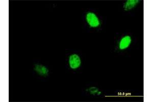 Immunofluorescence of purified MaxPab antibody to MGMT on HeLa cell.