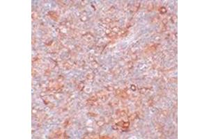 Immunohistochemistry of TMEM38B in mouse thymus tissue with this product at 5 μg/ml. (TMEM38B anticorps  (C-Term))
