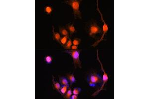 Immunofluorescence analysis of U-251 MG cells using PGP9. (UCHL1 anticorps  (AA 59-223))