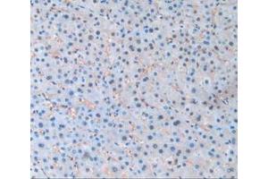 Detection of PANX1 in Human Liver Tissue using Polyclonal Antibody to Pannexin 1 (PANX1)