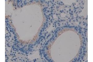 Detection of MUC1 in Mouse Lung Tissue using Polyclonal Antibody to Mucin 1 (MUC1)
