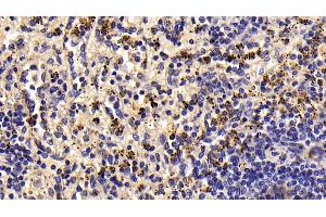 Detection of LTbR in Human Spleen Tissue using Monoclonal Antibody to Lymphotoxin Beta Receptor (LTbR) (LTBR anticorps  (AA 66-215))