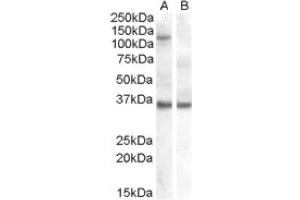 Image no. 1 for anti-Eukaryotic Translation Initiation Factor 2C, 1 (EIF2C1) (Internal Region) antibody (ABIN374655) (AGO1 anticorps  (Internal Region))