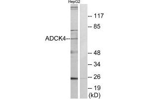 Western Blotting (WB) image for anti-AarF Domain Containing Kinase 4 (ADCK4) (N-Term) antibody (ABIN1849898) (ADCK4 anticorps  (N-Term))