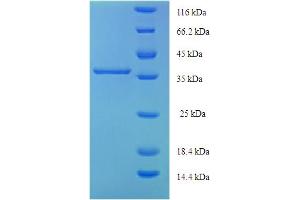 SDS-PAGE (SDS) image for Cytoglobin (CYGB) (AA 1-190), (full length) protein (His-SUMO Tag) (ABIN5709375)