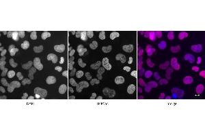 Detection of H4K5ac by immunofluorescence. (Histone H4 anticorps  (acLys5))