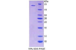 SDS-PAGE analysis of Rat CD19 Protein. (CD19 Protéine)