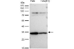 All lanes use the Antibody at 1:1K dilution for 1 hour at room temperature.
