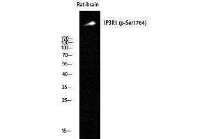 Western Blotting (WB) image for anti-Inositol 1,4,5-Trisphosphate Receptor, Type 1 (ITPR1) (pSer1764) antibody (ABIN3173506) (ITPR1 anticorps  (pSer1764))