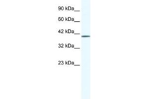 WB Suggested Anti-ZNF322A Antibody Titration:  0. (ZNF322A anticorps  (N-Term))