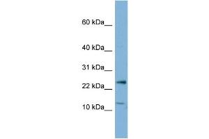 WB Suggested Anti-PPP1R11  Antibody Titration: 0.