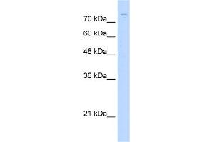 WB Suggested Anti-ZNF709 Antibody Titration:  1. (ZNF709 anticorps  (N-Term))