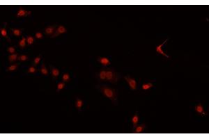 ABIN6269380 staining HeLa cells by IF/ICC. (PDCD4 anticorps  (C-Term))