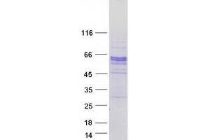 Validation with Western Blot
