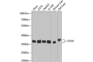 Western blot analysis of extracts of various cell lines using CPOX Polyclonal Antibody at dilution of 1:1000. (CPOX anticorps)