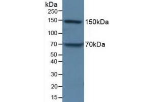 Detection of APOB in Porcine Liver Tissue using Polyclonal Antibody to Apolipoprotein B (APOB) (APOB anticorps  (AA 3365-3548))