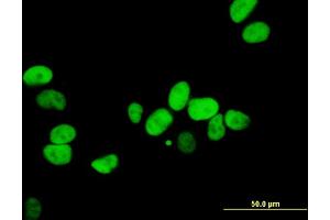 Immunofluorescence of monoclonal antibody to XRCC5 on HeLa cell.