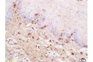 Formalin-fixed and paraffin embedded rat tongue labeled with Anti SynCAM/TSLC1 Polyclonal Antibody, Unconjugated (ABIN761351) at 1:200 followed by conjugation to the secondary antibody and DAB staining