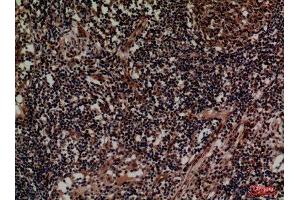 Immunohistochemistry (IHC) analysis of paraffin-embedded Human Lymph, antibody was diluted at 1:100. (CD1d anticorps  (Internal Region))