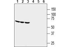 Western blot analysis of human THP-1 monocytic leukemia (lanes 1 and 4), human HL-60 promyelocytic leukemia (lanes 2 and 5) and human U-87 MG glioblastoma (lanes 3 and 6) cell line lysates: - 1-3. (GPR84 anticorps  (2nd Extracellular Loop))
