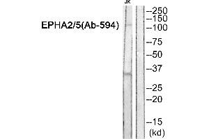 Western blot analysis of extracts from JK cells, using EPHA2/5 (Ab-594) Antibody. (EPHA2/5 (Tyr594) anticorps)