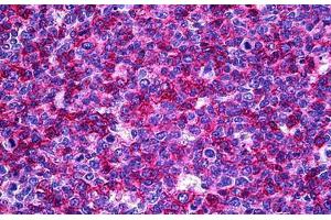 Human Tonsil: Formalin-Fixed, Paraffin-Embedded (FFPE)