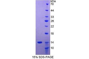 SDS-PAGE analysis of Human MHCG Protein. (HLAG Protéine)