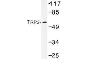 Image no. 1 for anti-Dopachrome Tautomerase (DCT) antibody (ABIN317917) (DCT anticorps)