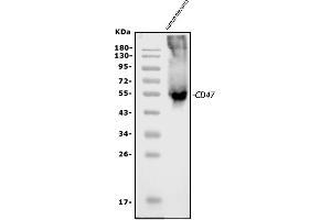 Western blot analysis of CD47 using anti-CD47 antibody (ABIN6719291). (CD47 anticorps  (AA 19-323))