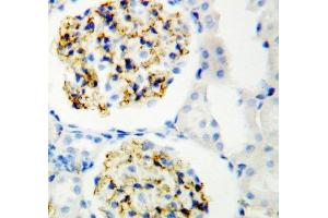 IHC-P: CD34 antibody testing of rat kidney (CD34 anticorps  (C-Term))