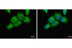 ICC/IF Image uPAR antibody detects uPAR protein at cytoplasm by immunofluorescent analysis. (PLAUR anticorps)