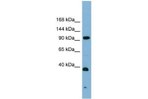 WB Suggested Anti-ERCC4  Antibody Titration: 0.