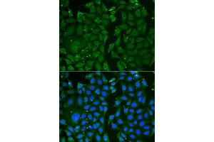 Immunofluorescence analysis of U2OS cells using TKT antibody.