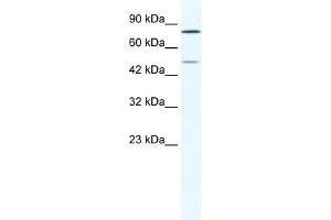 Western Blot showing ZNF12 antibody used at a concentration of 1-2 ug/ml to detect its target protein. (ZNF12 anticorps  (N-Term))