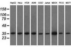 Western blot analysis of extracts (35 µg) from 9 different cell lines by using anti-EIF2S1 monoclonal antibody. (EIF2S1 anticorps)