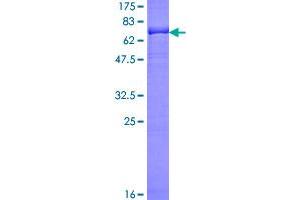 Image no. 2 for 3-phosphoinositide Dependent Protein Kinase-1 (PDPK1) (AA 1-429) protein (GST tag) (ABIN1314576)