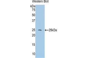 Western blot analysis of the recombinant protein. (CD8 alpha anticorps  (AA 26-236))