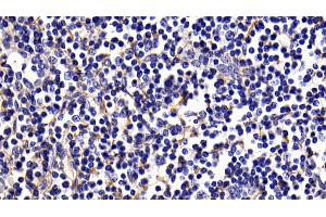 Detection of COL1a1 in Human Lymph node Tissue using Monoclonal Antibody to Collagen Type I Alpha 1 (COL1a1)