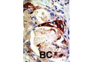 Immunohistochemistry (IHC) image for anti-V-Myb Myeloblastosis Viral Oncogene Homolog (Avian) (MYB) (Sumoylation Site) antibody (ABIN3001528)